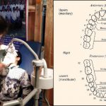 14 dental points ssb