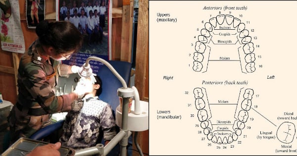 14 dental points ssb