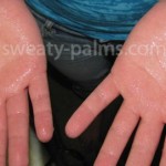 sweaty palms ssb interview medical