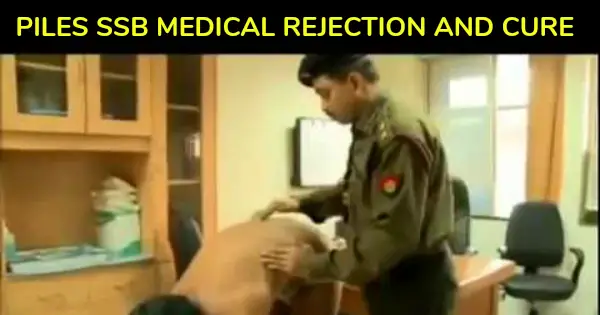 PILES SSB MEDICAL REJECTION AND CURE