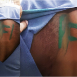 Indian Army Jawan PFI